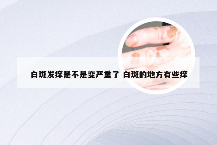 白斑发痒是不是变严重了 白斑的地方有些痒