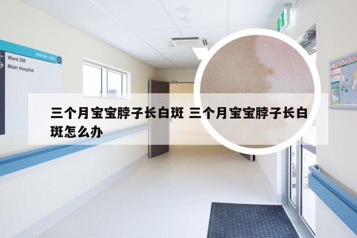 三个月宝宝脖子长白斑 三个月宝宝脖子长白斑怎么办