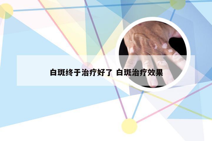 白斑终于治疗好了 白斑治疗效果