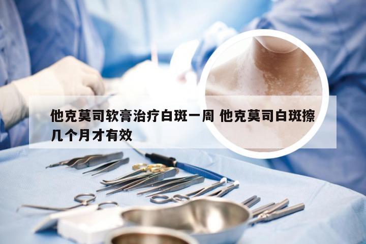 他克莫司软膏治疗白斑一周 他克莫司白斑擦几个月才有效