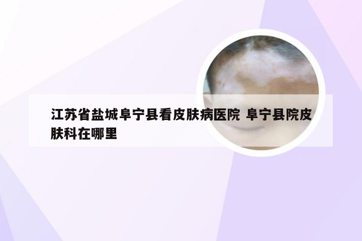 江苏省盐城阜宁县看皮肤病医院 阜宁县院皮肤科在哪里