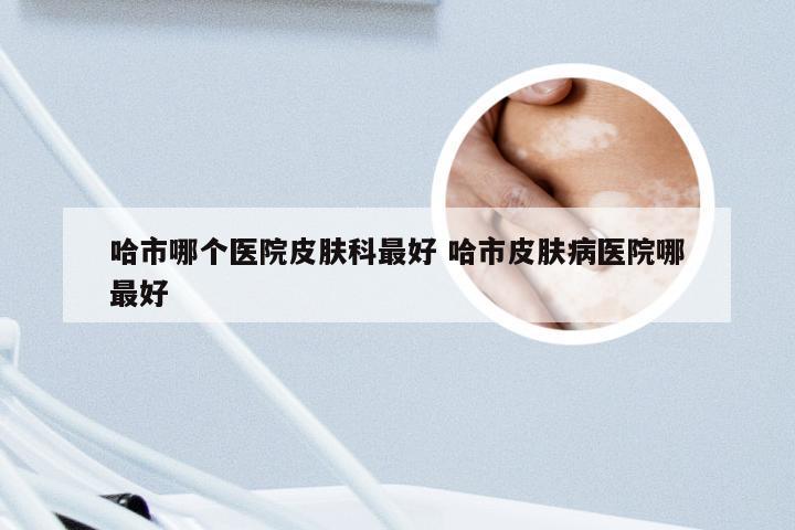 哈市哪个医院皮肤科最好 哈市皮肤病医院哪最好