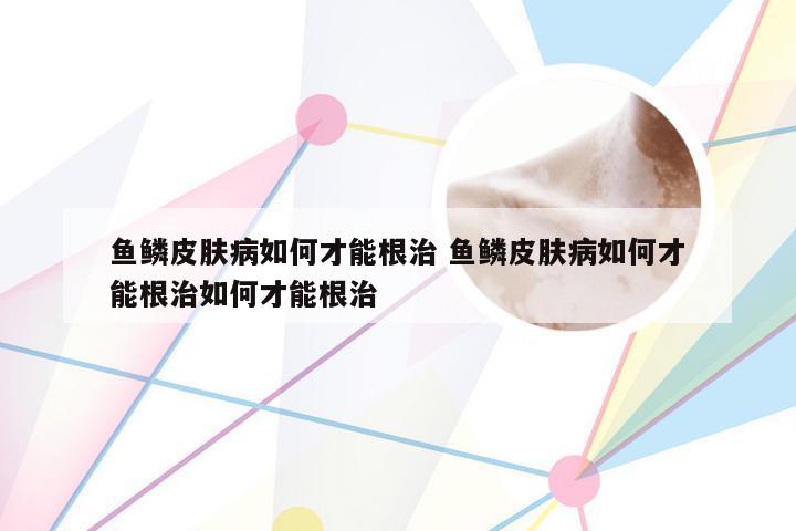 鱼鳞皮肤病如何才能根治 鱼鳞皮肤病如何才能根治如何才能根治