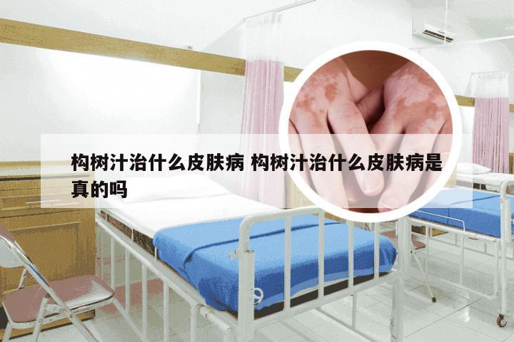 构树汁治什么皮肤病 构树汁治什么皮肤病是真的吗