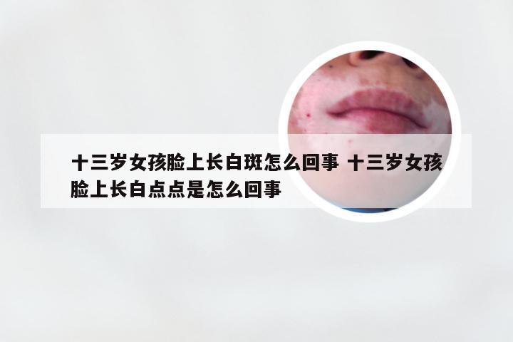 十三岁女孩脸上长白斑怎么回事 十三岁女孩脸上长白点点是怎么回事