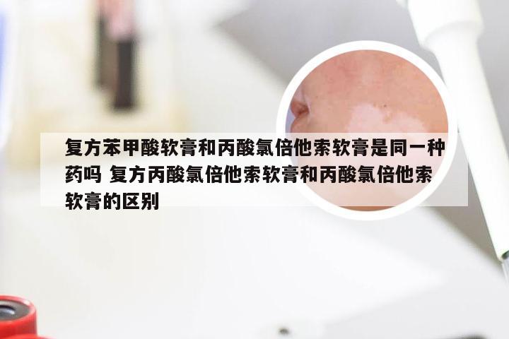 复方苯甲酸软膏和丙酸氯倍他索软膏是同一种药吗 复方丙酸氯倍他索软膏和丙酸氯倍他索软膏的区别
