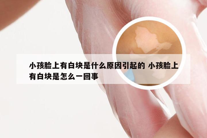 小孩脸上有白块是什么原因引起的 小孩脸上有白块是怎么一回事