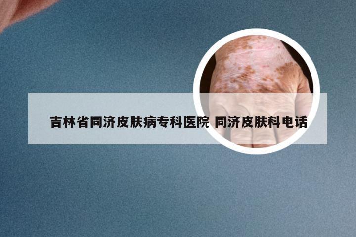 吉林省同济皮肤病专科医院 同济皮肤科电话