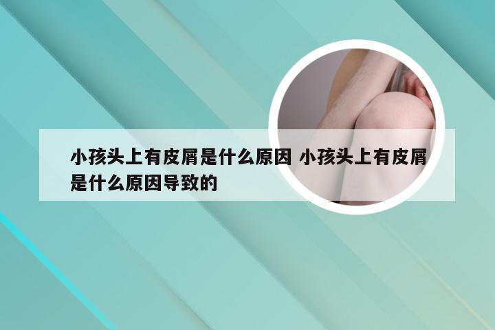 小孩头上有皮屑是什么原因 小孩头上有皮屑是什么原因导致的