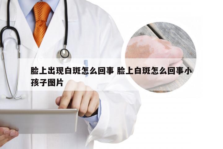 脸上出现白斑怎么回事 脸上白斑怎么回事小孩子图片
