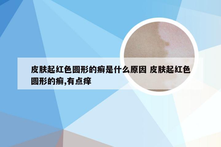 皮肤起红色圆形的癣是什么原因 皮肤起红色圆形的癣,有点痒
