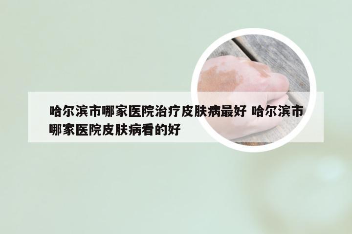 哈尔滨市哪家医院治疗皮肤病最好 哈尔滨市哪家医院皮肤病看的好