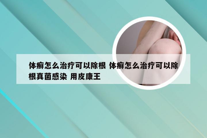 体癣怎么治疗可以除根 体癣怎么治疗可以除根真菌感染 用皮康王