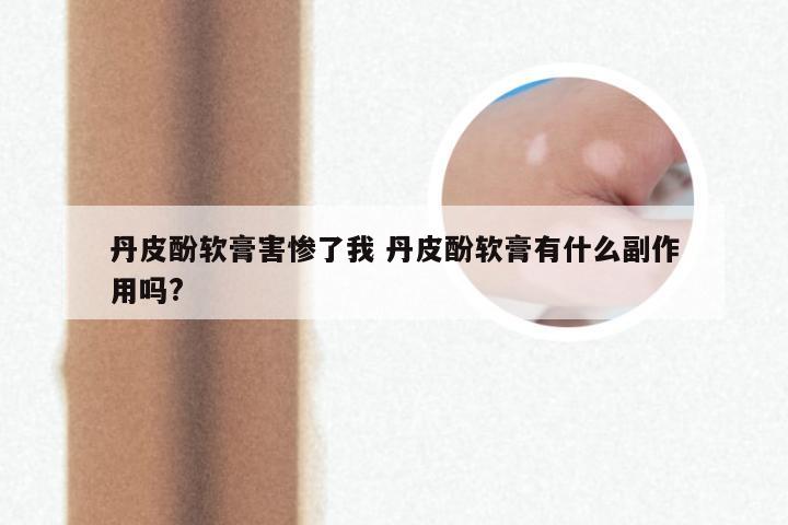 丹皮酚软膏害惨了我 丹皮酚软膏有什么副作用吗?