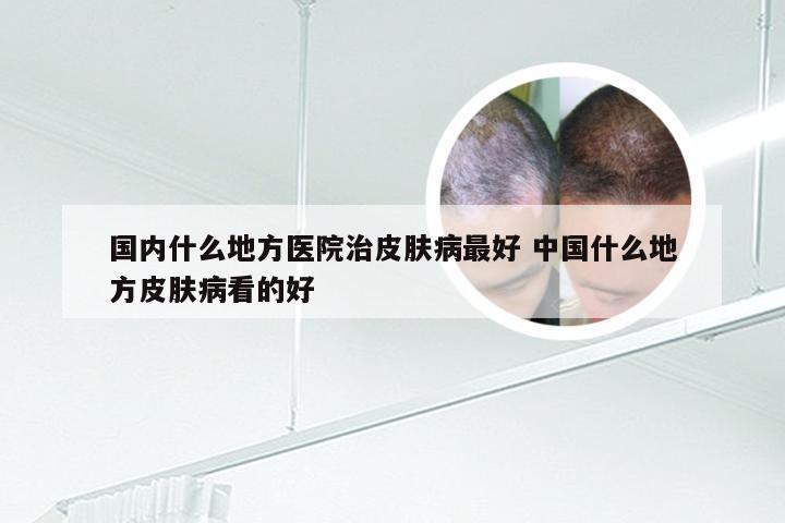 国内什么地方医院治皮肤病最好 中国什么地方皮肤病看的好