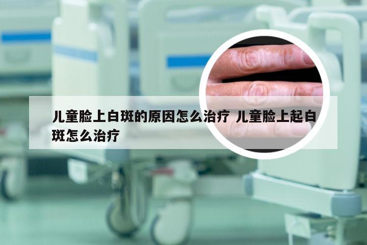 儿童脸上白斑的原因怎么治疗 儿童脸上起白斑怎么治疗