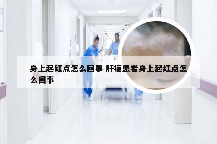身上起红点怎么回事 肝癌患者身上起红点怎么回事