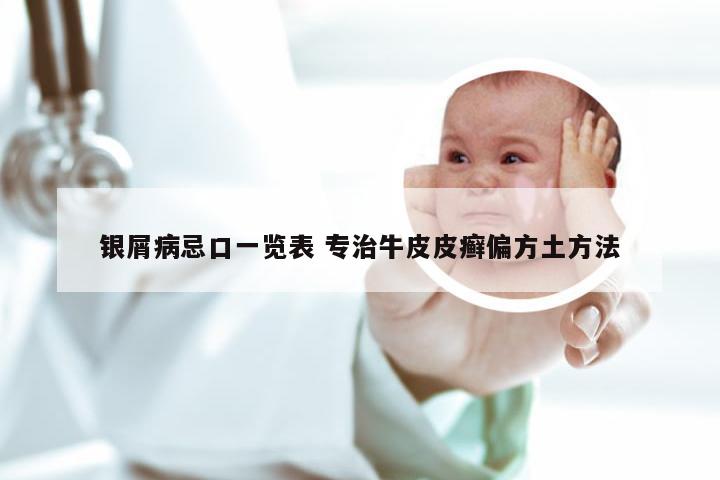 银屑病忌口一览表 专治牛皮皮癣偏方土方法