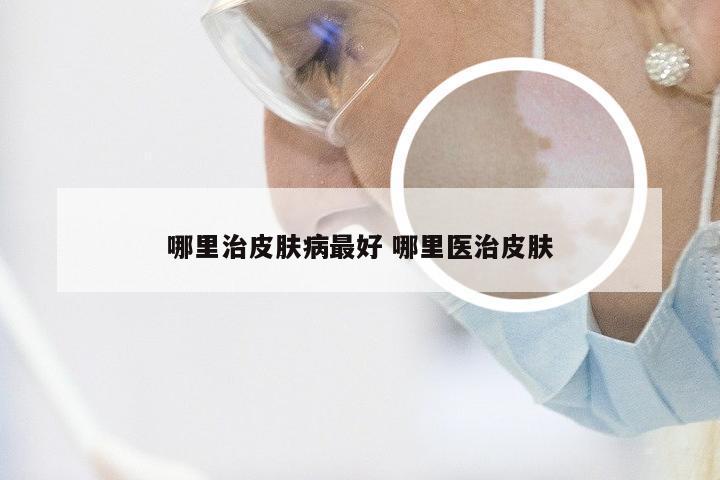 哪里治皮肤病最好 哪里医治皮肤