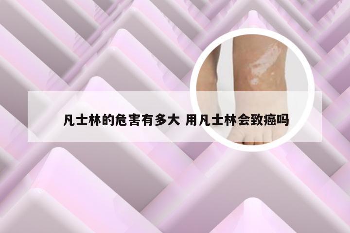 凡士林的危害有多大 用凡士林会致癌吗