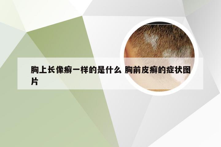 胸上长像癣一样的是什么 胸前皮癣的症状图片