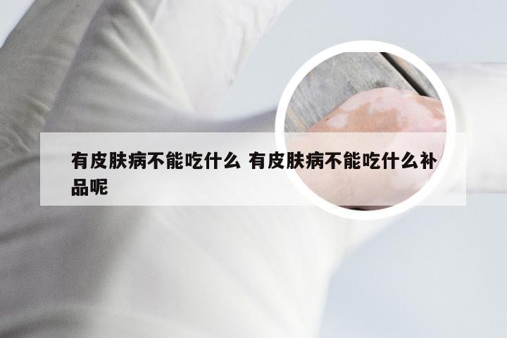 有皮肤病不能吃什么 有皮肤病不能吃什么补品呢