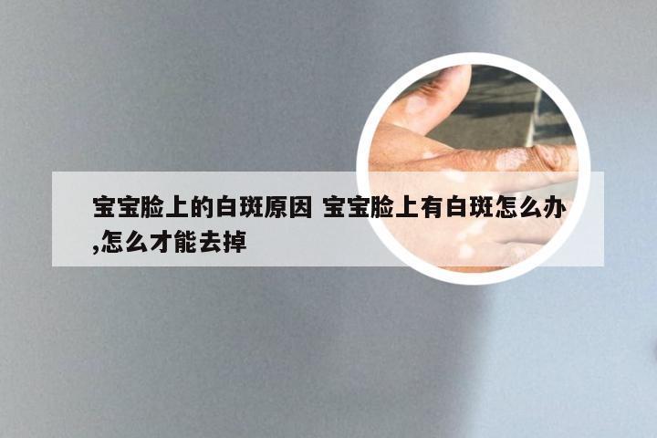 宝宝脸上的白斑原因 宝宝脸上有白斑怎么办,怎么才能去掉