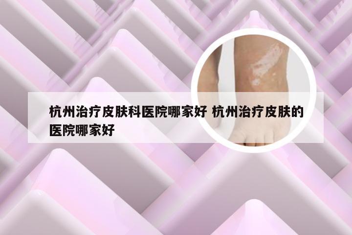 杭州治疗皮肤科医院哪家好 杭州治疗皮肤的医院哪家好