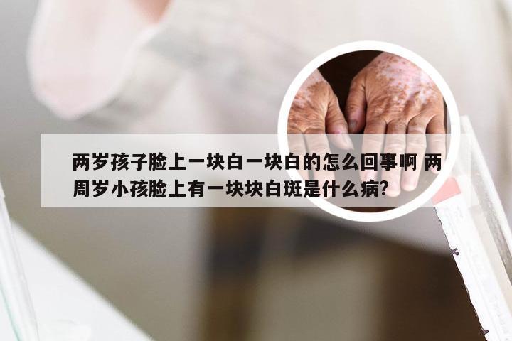 两岁孩子脸上一块白一块白的怎么回事啊 两周岁小孩脸上有一块块白斑是什么病?