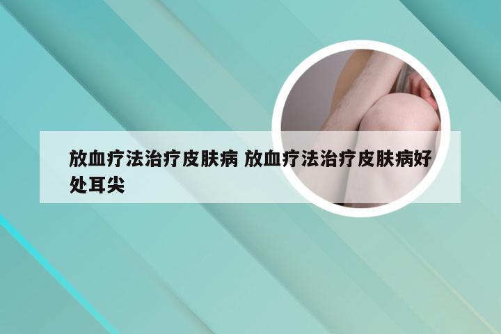 放血疗法治疗皮肤病 放血疗法治疗皮肤病好处耳尖