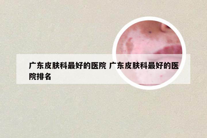 广东皮肤科最好的医院 广东皮肤科最好的医院排名