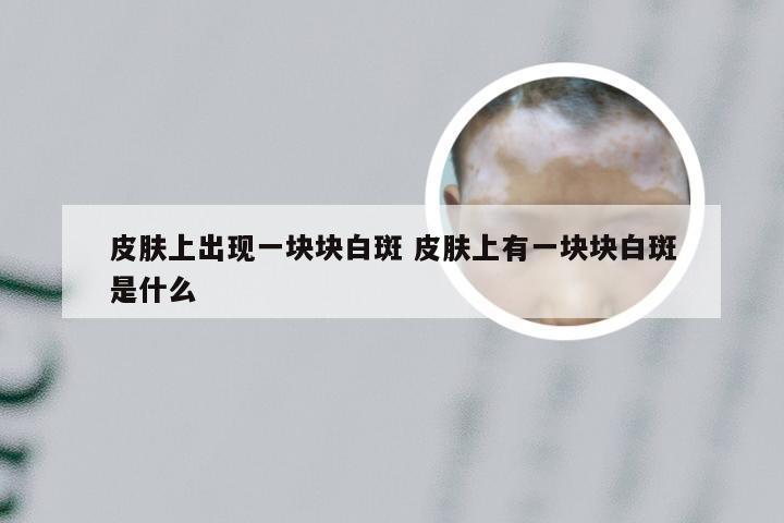 皮肤上出现一块块白斑 皮肤上有一块块白斑是什么