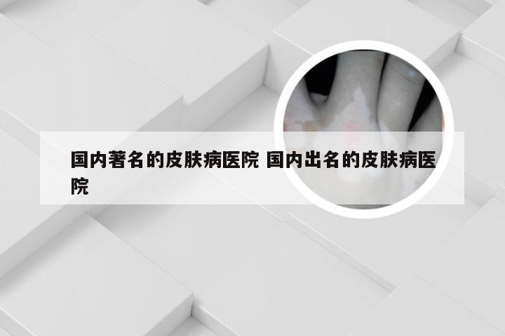 国内著名的皮肤病医院 国内出名的皮肤病医院