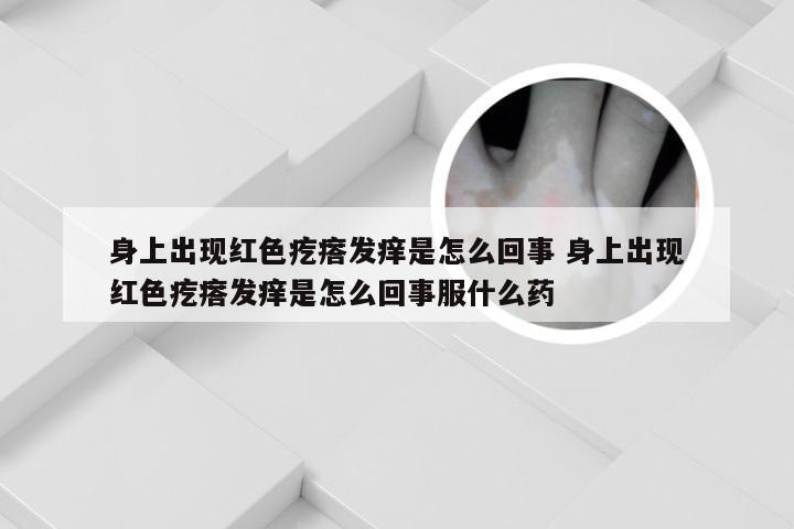 身上出现红色疙瘩发痒是怎么回事 身上出现红色疙瘩发痒是怎么回事服什么药