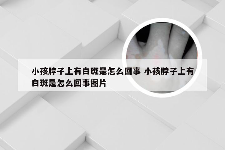 小孩脖子上有白斑是怎么回事 小孩脖子上有白斑是怎么回事图片