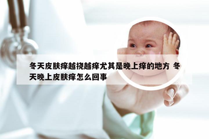 冬天皮肤痒越挠越痒尤其是晚上痒的地方 冬天晚上皮肤痒怎么回事
