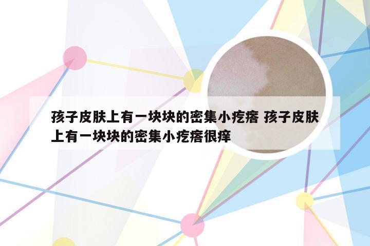 孩子皮肤上有一块块的密集小疙瘩 孩子皮肤上有一块块的密集小疙瘩很痒