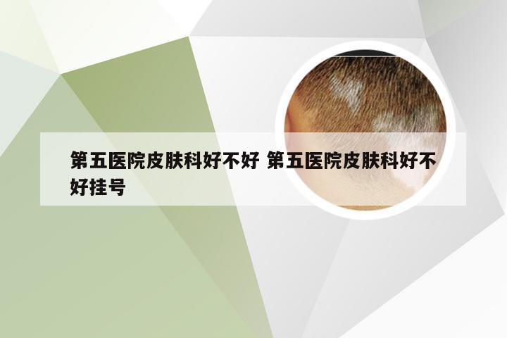 第五医院皮肤科好不好 第五医院皮肤科好不好挂号