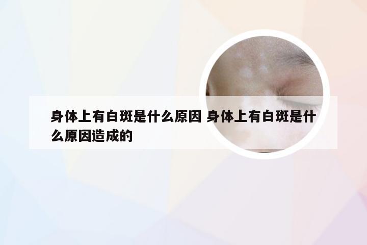 身体上有白斑是什么原因 身体上有白斑是什么原因造成的