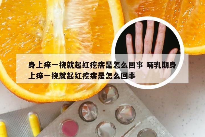 身上痒一挠就起红疙瘩是怎么回事 哺乳期身上痒一挠就起红疙瘩是怎么回事