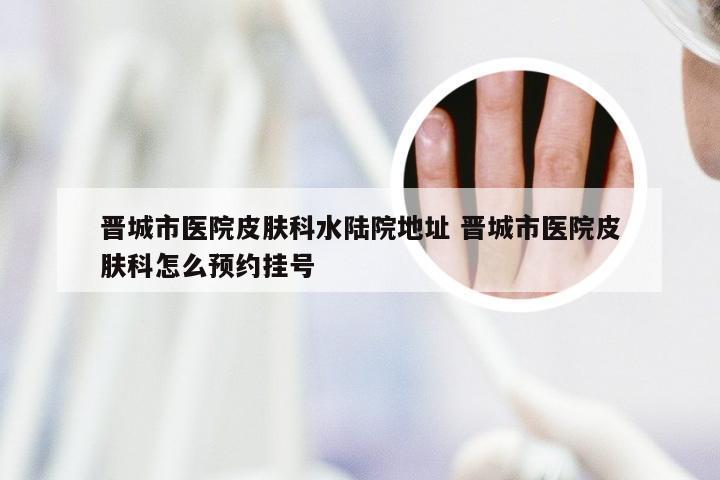 晋城市医院皮肤科水陆院地址 晋城市医院皮肤科怎么预约挂号