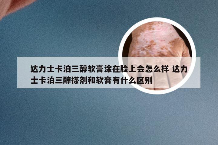 达力士卡泊三醇软膏涂在脸上会怎么样 达力士卡泊三醇搽剂和软膏有什么区别