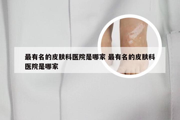 最有名的皮肤科医院是哪家 最有名的皮肤科医院是哪家