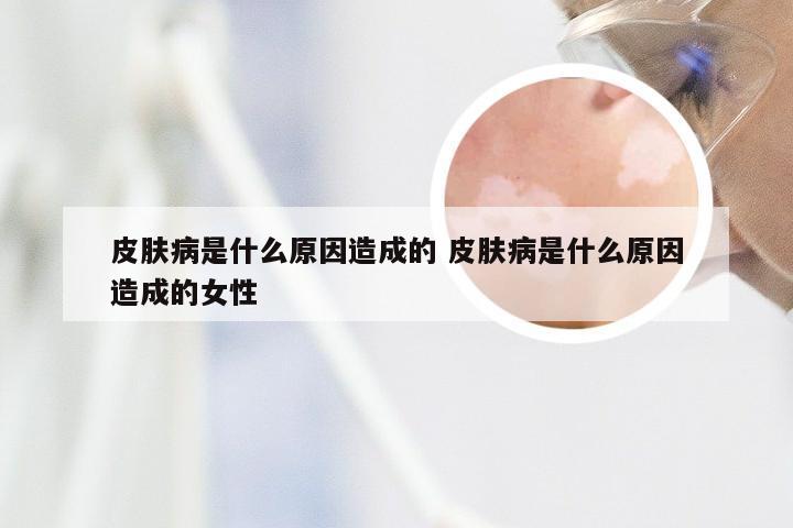 皮肤病是什么原因造成的 皮肤病是什么原因造成的女性