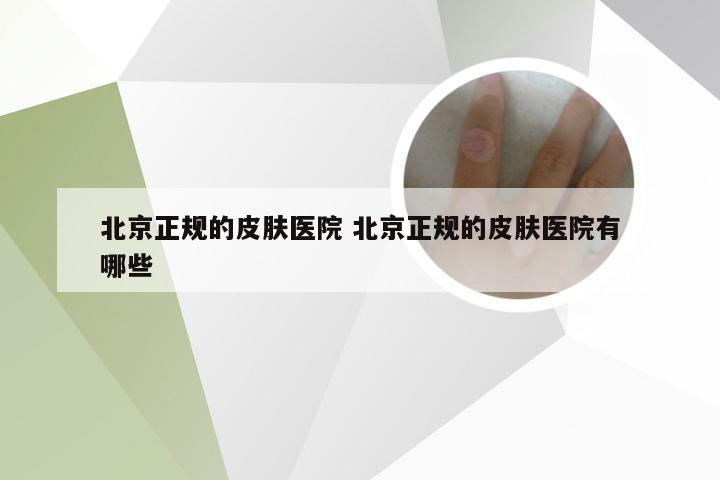 北京正规的皮肤医院 北京正规的皮肤医院有哪些