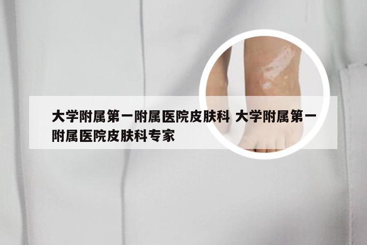大学附属第一附属医院皮肤科 大学附属第一附属医院皮肤科专家