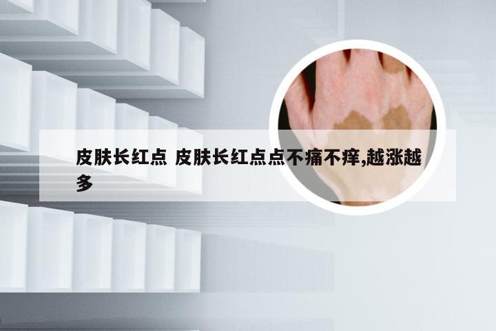 皮肤长红点 皮肤长红点点不痛不痒,越涨越多