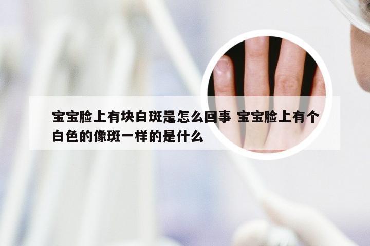 宝宝脸上有块白斑是怎么回事 宝宝脸上有个白色的像斑一样的是什么