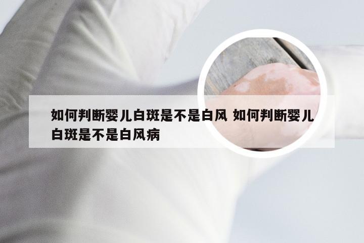 如何判断婴儿白斑是不是白风 如何判断婴儿白斑是不是白风病