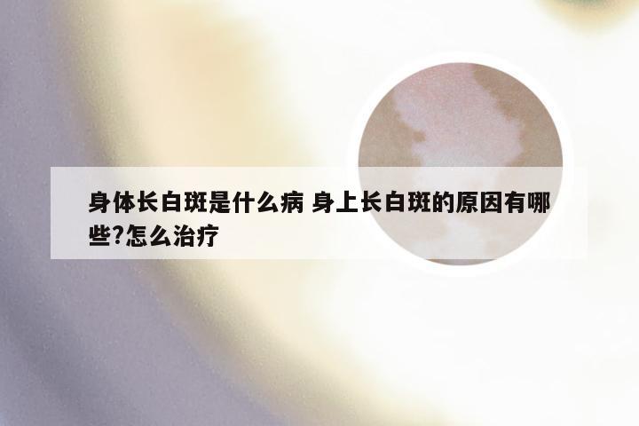 身体长白斑是什么病 身上长白斑的原因有哪些?怎么治疗
